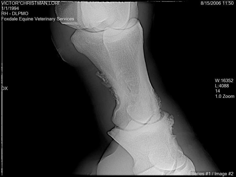 Image-RH - DLPMO-20060815115051.dcm.original.jpg